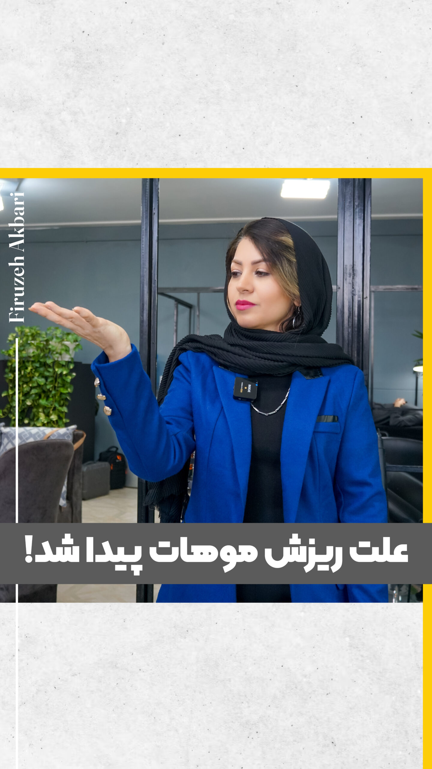 ریزش مو بعد از کراتین